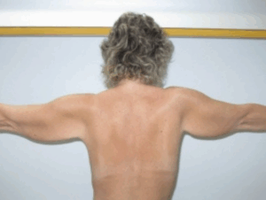 Chirurgie des bras