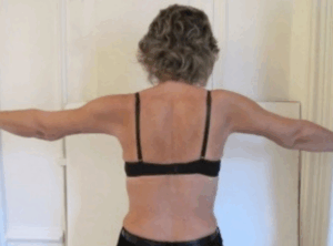 Chirurgie des bras